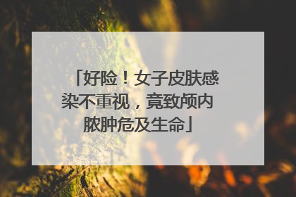 好险！女子皮肤感染不重视，竟致颅内脓肿危及生命