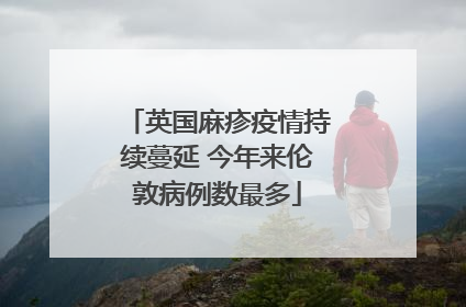 英国麻疹疫情持续蔓延 今年来伦敦病例数最多